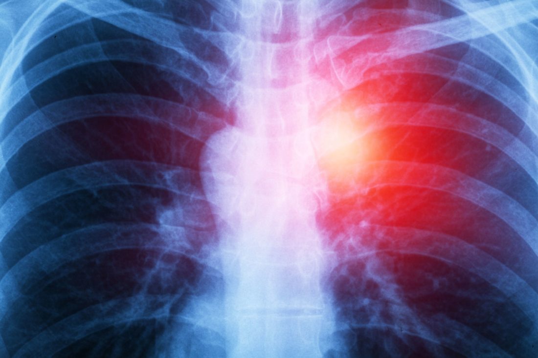 Do I need an asbestos management plan?